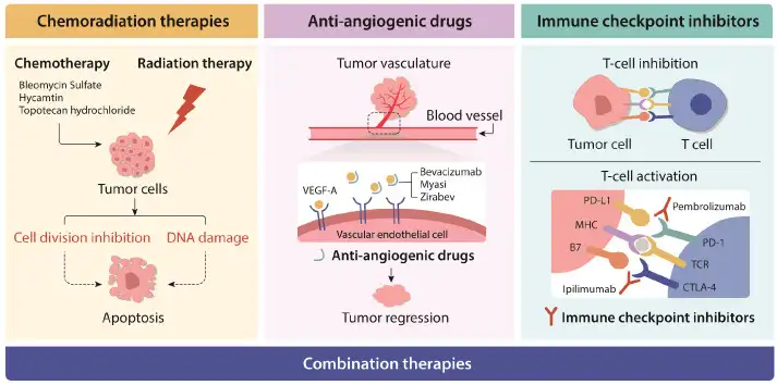 Diagram of cervical cancer treatment approaches: chemoradiation, anti-angiogenic drugs and immune checkpoint inhibitors