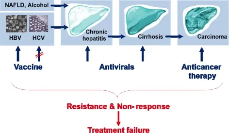 Diagram: progression from hepatitis B and C to chronic hepatitis, cirrhosis and liver cancer
