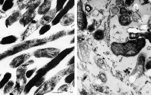 Electron micrographs of Mycobacterium tuberculosis bacteria in infected tissue