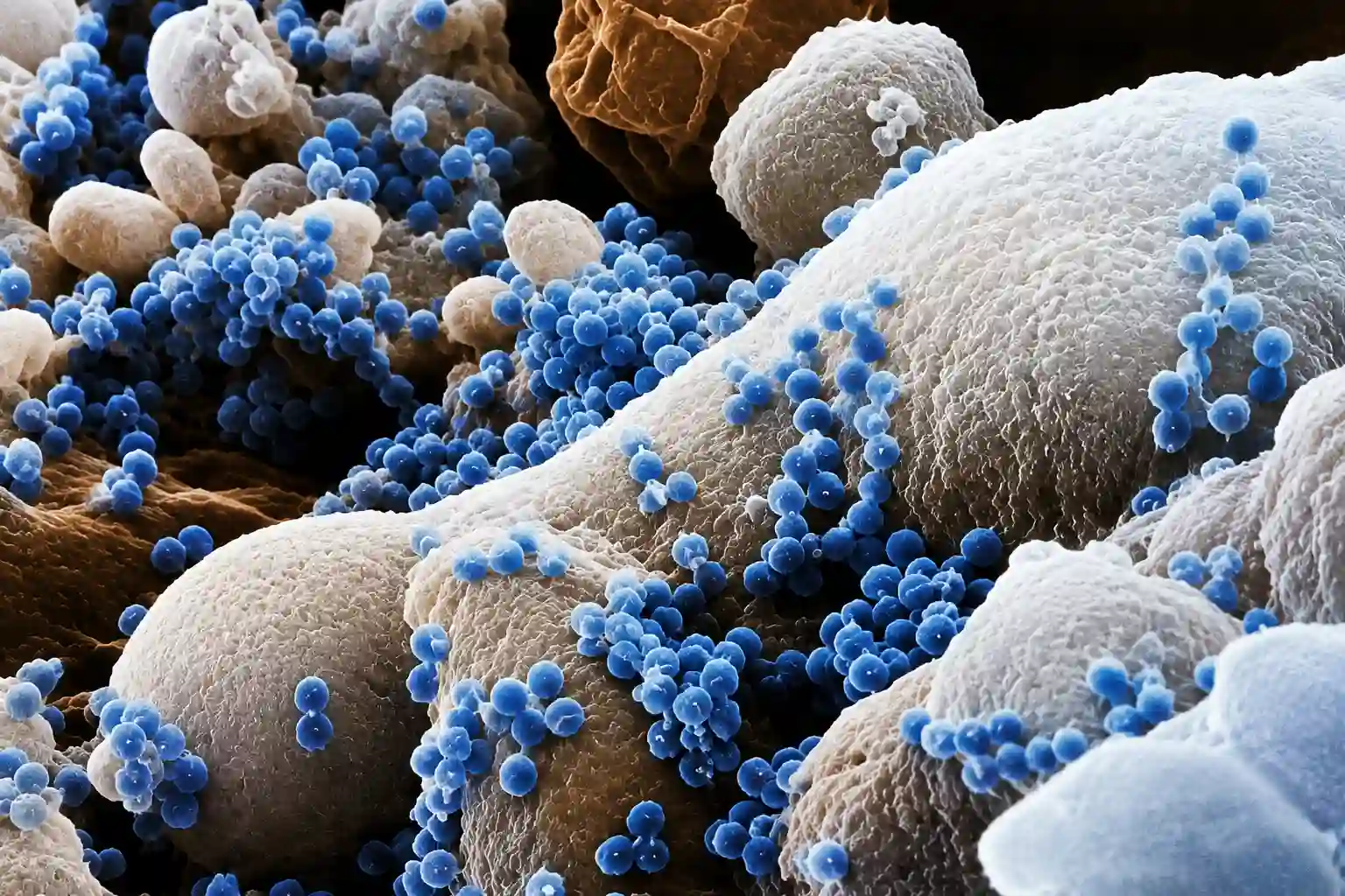 Electron micrograph of HIV virus particles budding from an infected cell